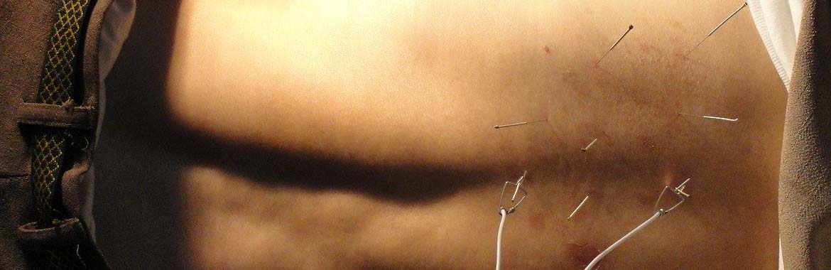 Torbay Acupuncture Clinic banner